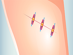 Funny Rescue Zookeeper